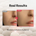 APOTHE Peptide Botulinum Multi Recovery Ampoule 30 ml – Inhaltsstoffe